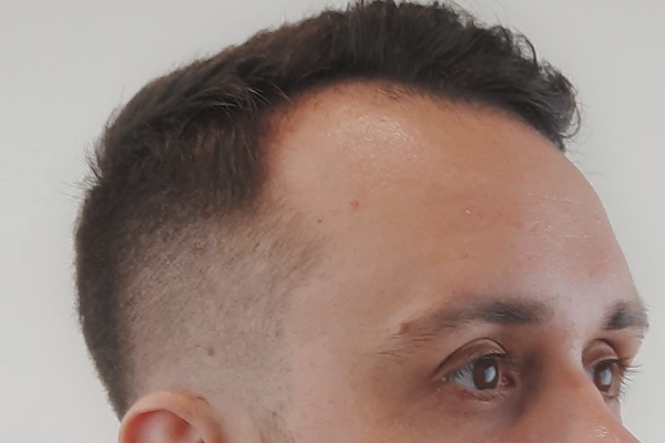 Fade
